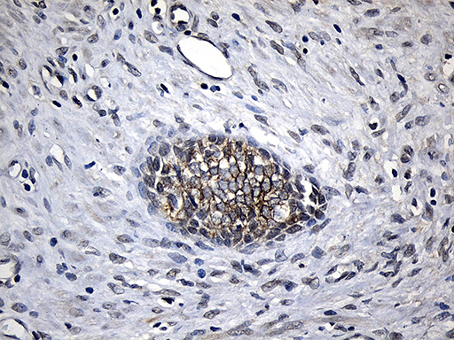 m03558 anti cpt1b mouse monoclonal antibody clone id oti2a6 ihc testing 5
