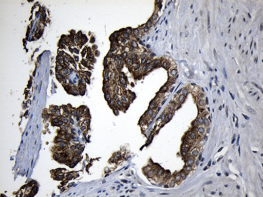 m03558 anti cpt1b mouse monoclonal antibody clone id oti2a6 ihc testing 6