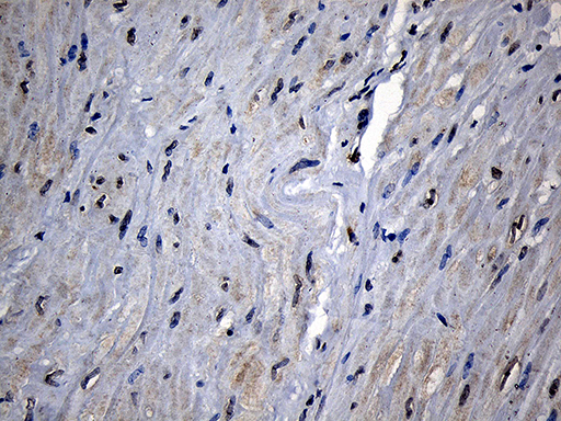 m03558 anti cpt1b mouse monoclonal antibody clone id oti2a6 ihc testing 7