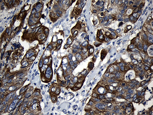m03558 anti cpt1b mouse monoclonal antibody clone id oti2a6 ihc testing 8