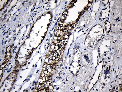 m03558 anti cpt1b mouse monoclonal antibody clone id oti2a6 ihc testing 9