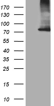 HEK293T cells were transfected with the pCMV6-ENTRY control (Left lane) or pCMV6-ENTRY CPT1B (Right lane) cDNA for 48 hrs and lysed