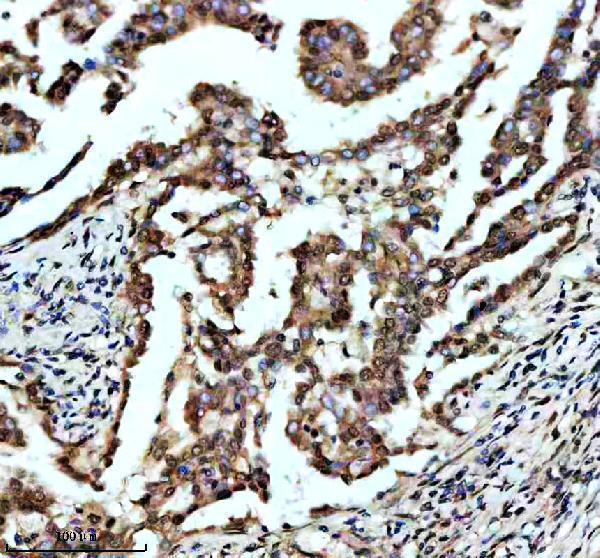 IHC analysis of FOXF1 using anti-FOXF1 antibody (M03563)