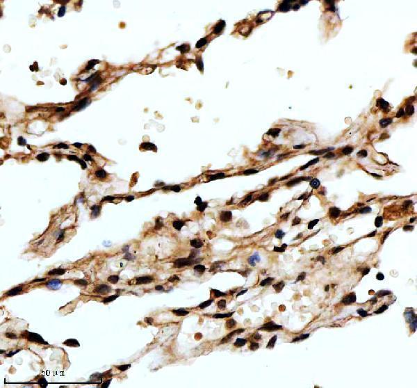 IHC analysis of FOXF1 using anti-FOXF1 antibody (M03563)