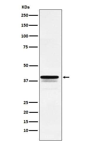 Western blot analysis of FOXF1 expression in HeLa cell lysate