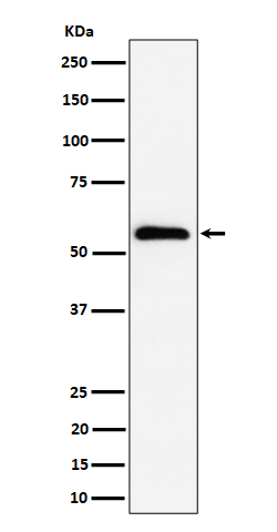 Western blot analysis of PNK / PNKP expression in HeLa cell lysate