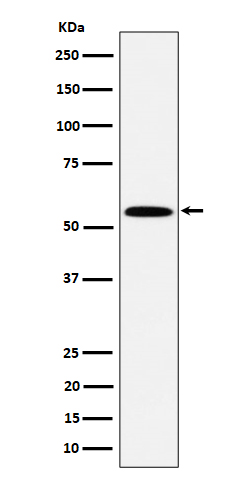 Western blot analysis of PNK / PNKP expression in Jurkat cell lysate