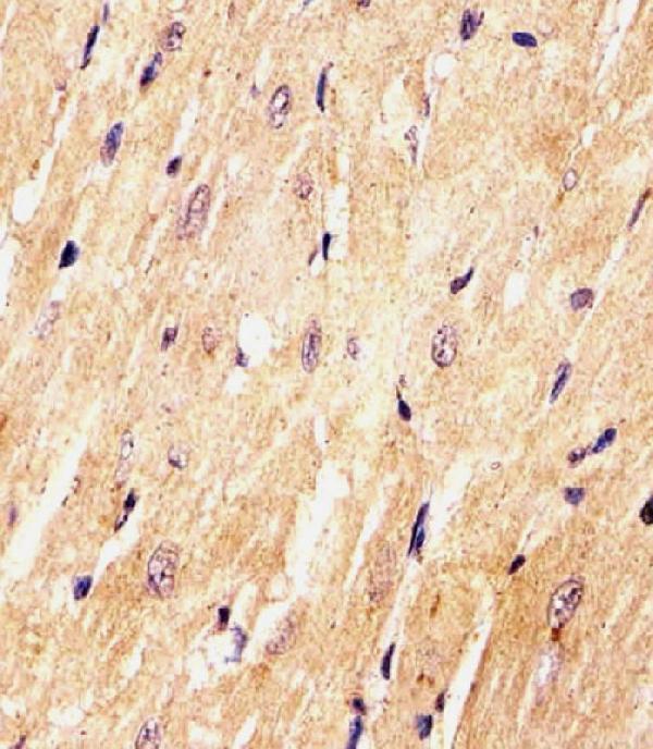 M03568-1 staining (Mouse) Med15 in Mouse heart tissue sections by Immunohistochemistry (IHC-P -paraformaldehyde-fixed, paraffin-embedded sections)