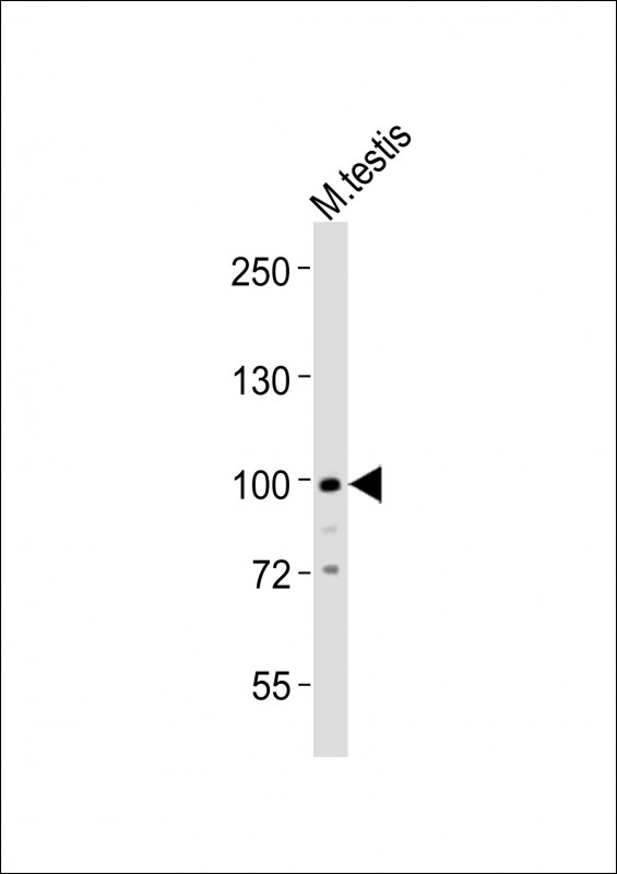 Anti-Med15 Antibody (C-term) at 1:1000 dilution + mouse testis lysatesLysates/proteins at 20 µg per lane