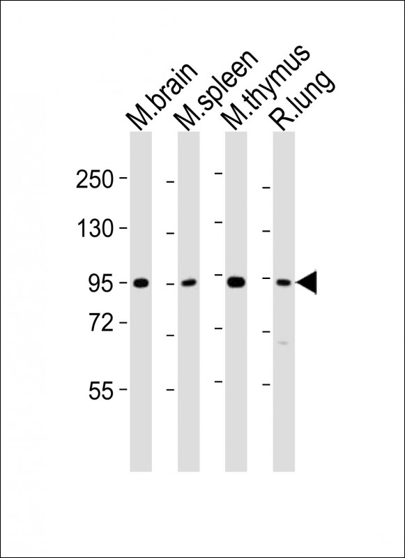 All lanes : Anti-Med15 Antibody (C-term) at 1:2000 dilutionLane 1: mouse brain lysatesLane 2: mouse spleen lysatesLane 3: mouse thymus lysatesLane 4: rat lung lysatesLysates/proteins at 20 µg per lane