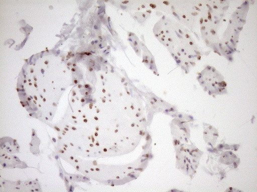 m03568 2 anti med15 mouse monoclonal antibody clone id oti1c11 ihc testing 10