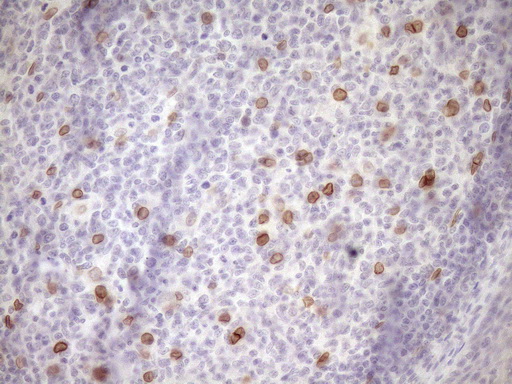 m03568 2 anti med15 mouse monoclonal antibody clone id oti1c11 ihc testing 11