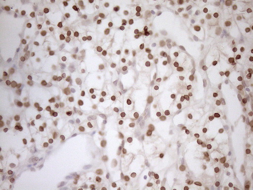 m03568 2 anti med15 mouse monoclonal antibody clone id oti1c11 ihc testing 12