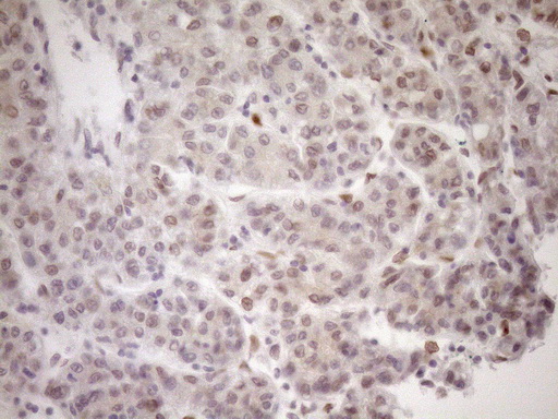 m03568 2 anti med15 mouse monoclonal antibody clone id oti1c11 ihc testing 13