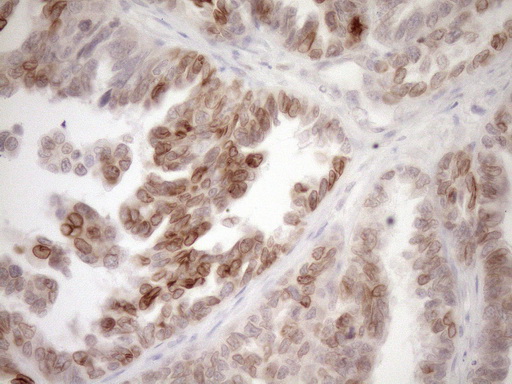 m03568 2 anti med15 mouse monoclonal antibody clone id oti1c11 ihc testing 2