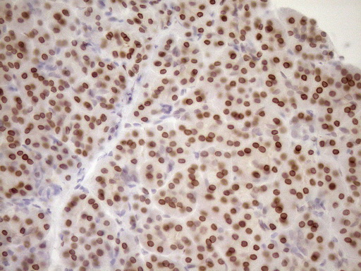 m03568 2 anti med15 mouse monoclonal antibody clone id oti1c11 ihc testing 3