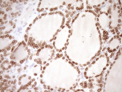 m03568 2 anti med15 mouse monoclonal antibody clone id oti1c11 ihc testing 4