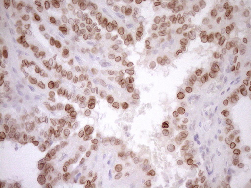 m03568 2 anti med15 mouse monoclonal antibody clone id oti1c11 ihc testing 5