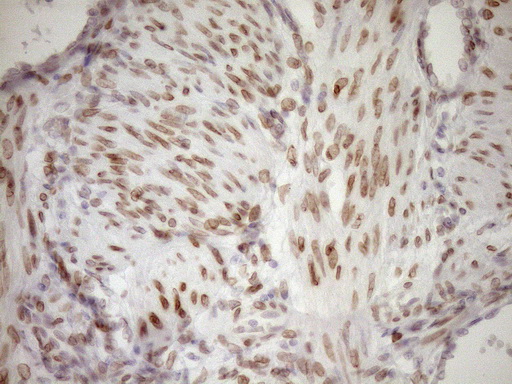 m03568 2 anti med15 mouse monoclonal antibody clone id oti1c11 ihc testing 6