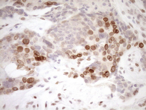 m03568 2 anti med15 mouse monoclonal antibody clone id oti1c11 ihc testing 7