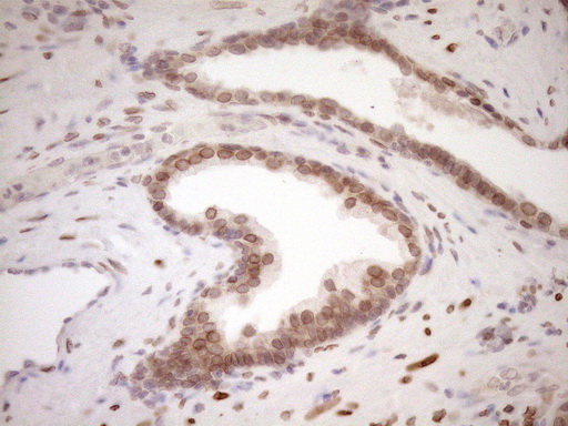 m03568 2 anti med15 mouse monoclonal antibody clone id oti1c11 ihc testing 9
