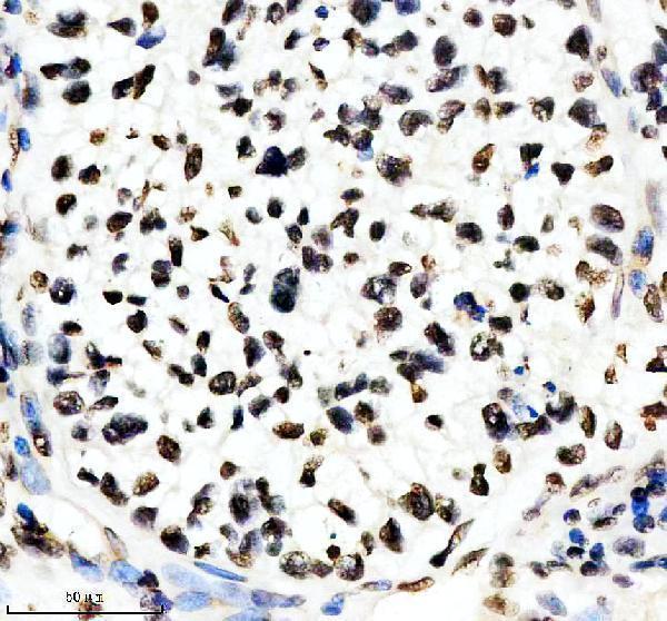 IHC analysis of ALY using anti-ALY antibody (M03580)