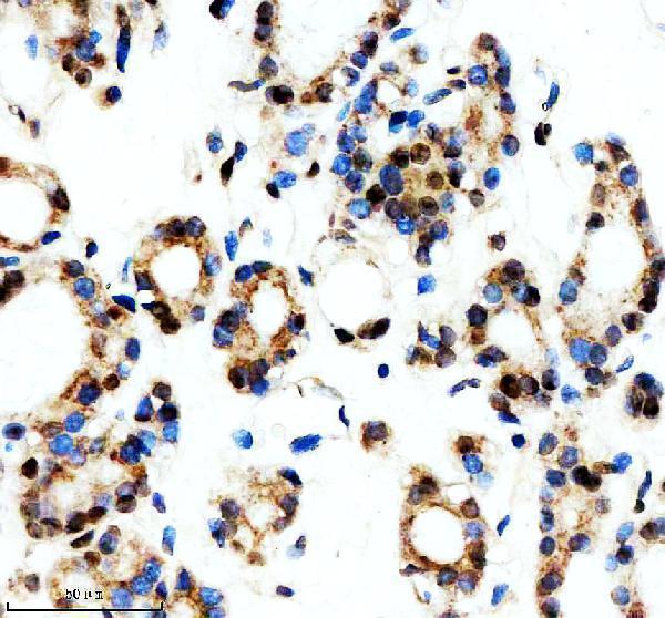m03580 aly primary antibodies ihc testing 10