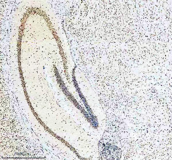 m03580 aly primary antibodies ihc testing 11