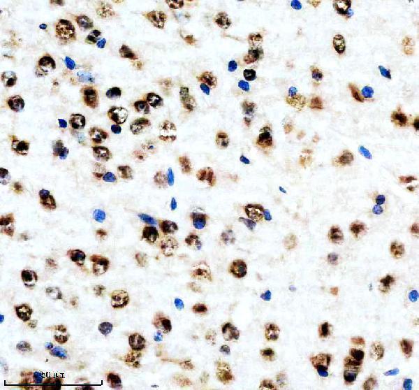 m03580 aly primary antibodies ihc testing 12