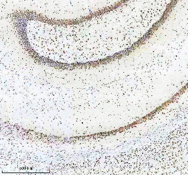 m03580 aly primary antibodies ihc testing 13