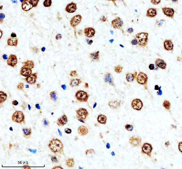 m03580 aly primary antibodies ihc testing 14