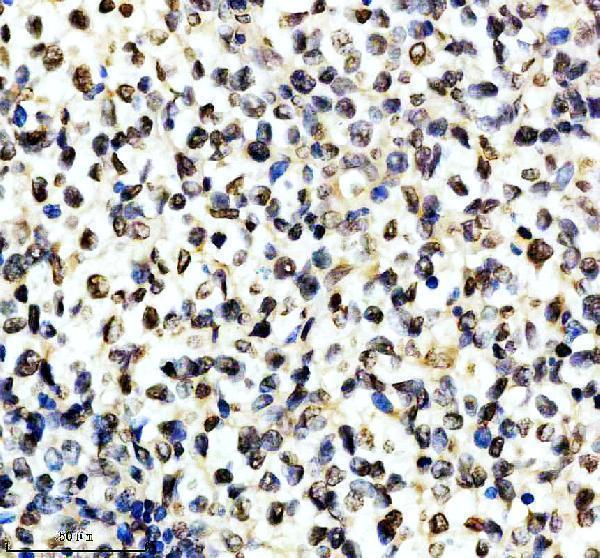 IHC analysis of ALY using anti-ALY antibody (M03580)