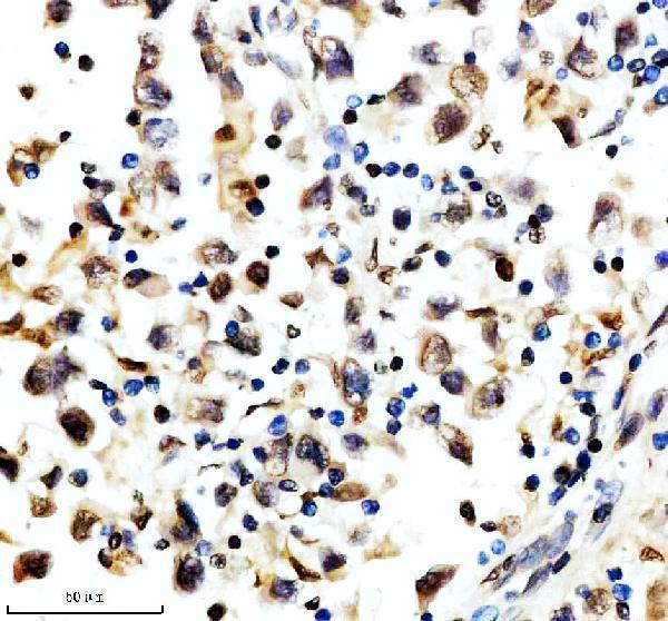 m03580 aly primary antibodies ihc testing 4