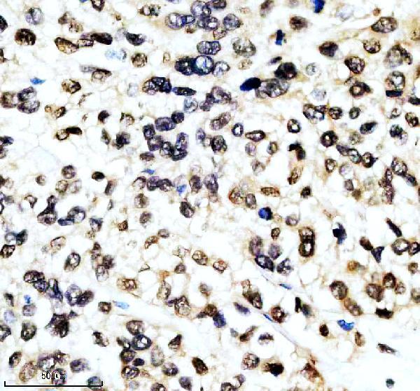 m03580 aly primary antibodies ihc testing 8