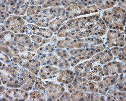 m03589 2 anti natriuretic peptide receptor c npr3 mouse monoclonal antibody clone id oti11a6 ihc testing 3