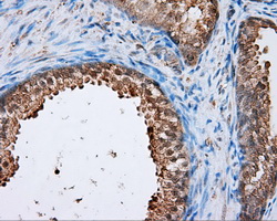 m03589 2 anti natriuretic peptide receptor c npr3 mouse monoclonal antibody clone id oti11a6 ihc testing 4