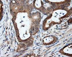 m03589 2 anti natriuretic peptide receptor c npr3 mouse monoclonal antibody clone id oti11a6 ihc testing 5