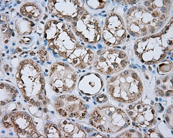 m03589 2 anti natriuretic peptide receptor c npr3 mouse monoclonal antibody clone id oti11a6 ihc testing 6