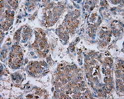 m03589 2 anti natriuretic peptide receptor c npr3 mouse monoclonal antibody clone id oti11a6 ihc testing 8