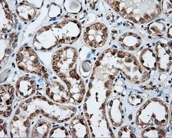 m03589 3 anti natriuretic peptide receptor c npr3 mouse monoclonal antibody clone id oti11b6 ihc testing 4
