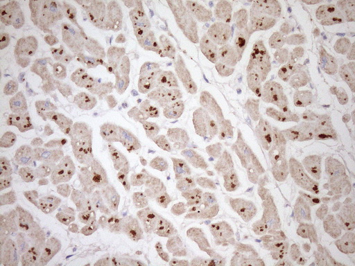 m03590 anti telethonin tcap mouse monoclonal antibody clone id oti3e7 ihc testing 2