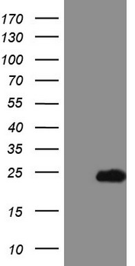 m03590 anti telethonin tcap mouse monoclonal antibody clone id oti3e7 wb testing 1