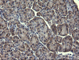 Immunohistochemical staining of paraffin-embedded Human pancreas tissue within the normal limits using anti-MAPK13 mouse monoclonal antibody