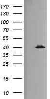HEK293T cells were transfected with the pCMV6-ENTRY control (Left lane) or pCMV6-ENTRY MAPK13 (Right lane) cDNA for 48 hrs and lysed
