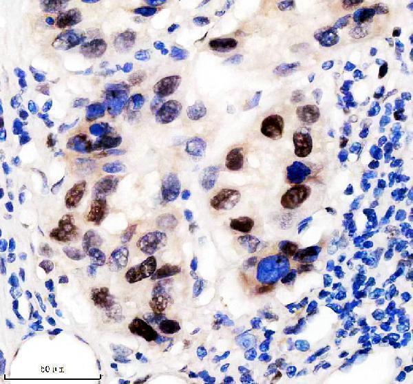 IHC analysis of KAT1 using anti-KAT1 antibody (M03596)