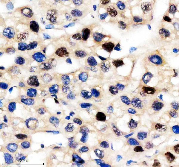 IHC analysis of KAT1 using anti-KAT1 antibody (M03596)