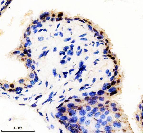 m03596 kat1 primary antibodies ihc testing 3