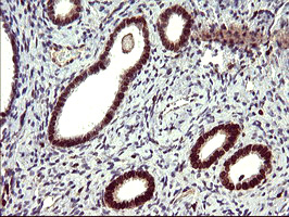 m03597 1 anti il10ra mouse monoclonal antibody clone id oti1d10 ihc testing 2