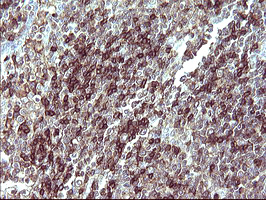 m03597 1 anti il10ra mouse monoclonal antibody clone id oti1d10 ihc testing 4