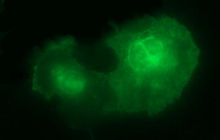 m03597 anti il10ra mouse monoclonal antibody clone id oti1g10 if testing 2